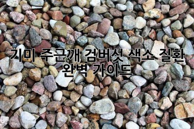 기미, 주근깨, 검버섯? 색소 질환 완벽 가이드